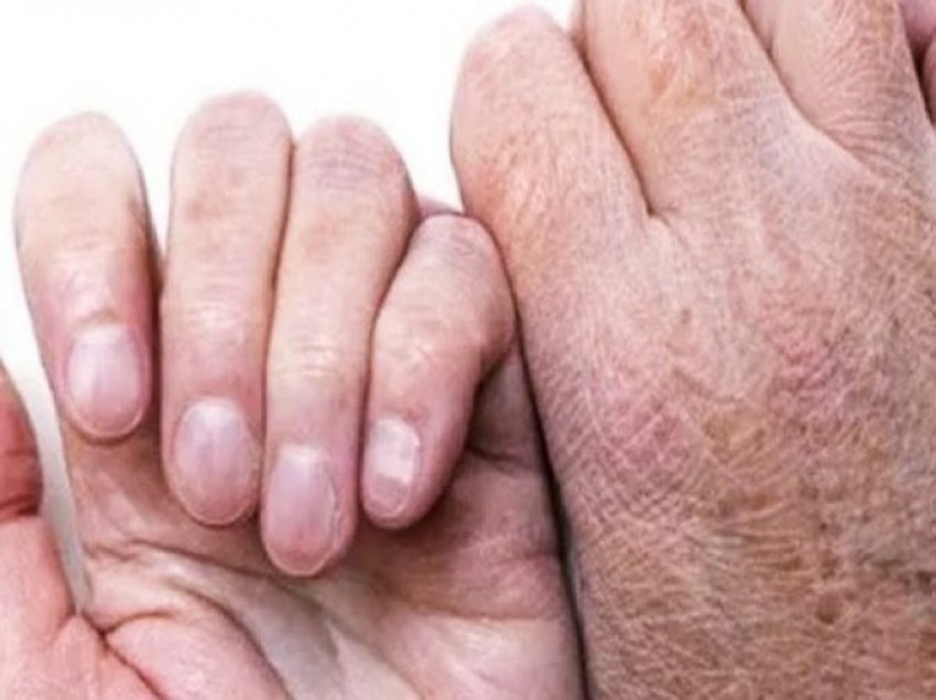 Mënyrat për të trajtuar duart e thara dhe të plasaritura në shtëpi