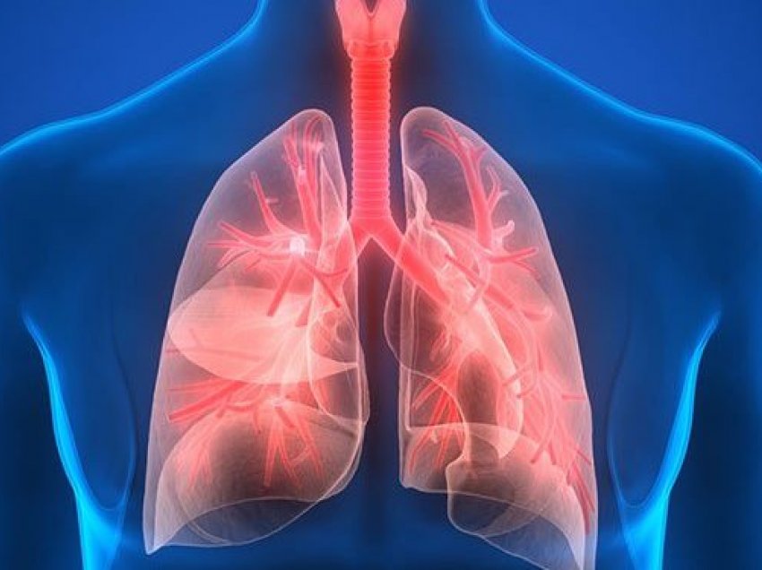 Si ta parandaloni infektimin nga pneumonia?