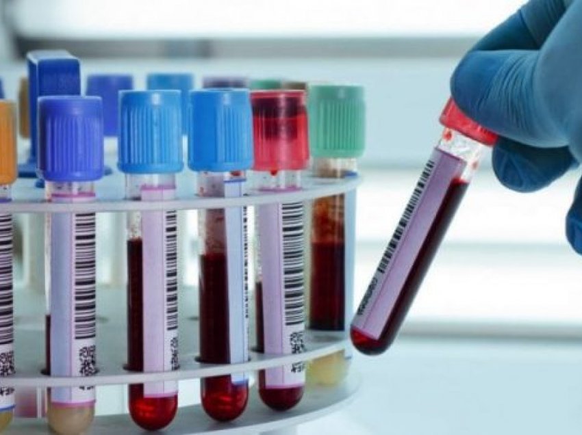 Në Kosovë s’ka asnjë rezervë të plazmës së gjakut për pacientët me COVID-19