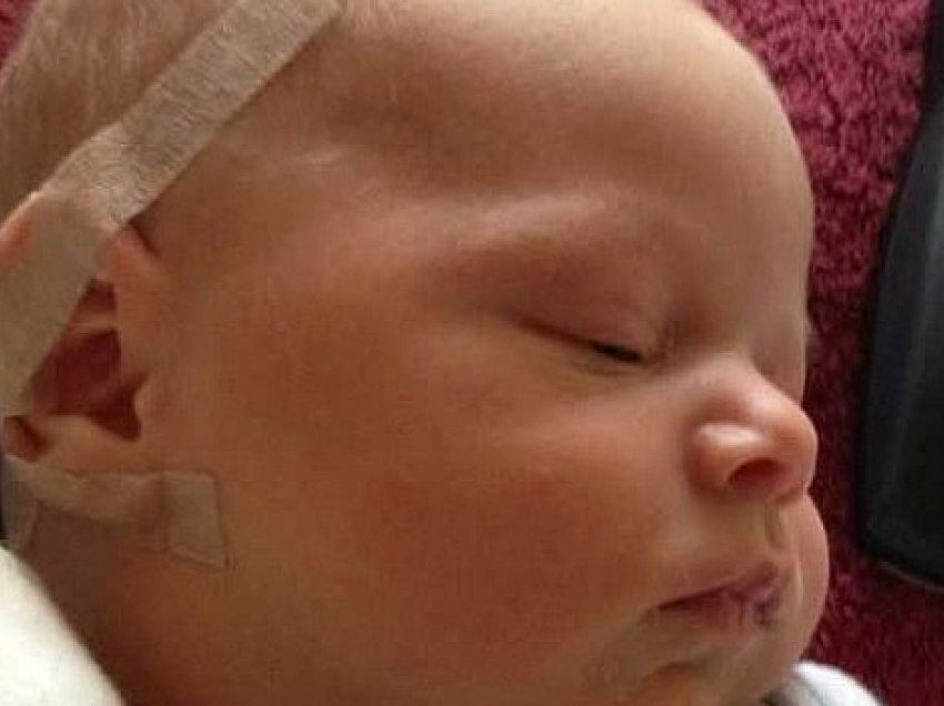 A mundet shiriti rreth kokës së foshnjës të zvogëlojë veshët llapush? Mjekët jepin përgjigjen