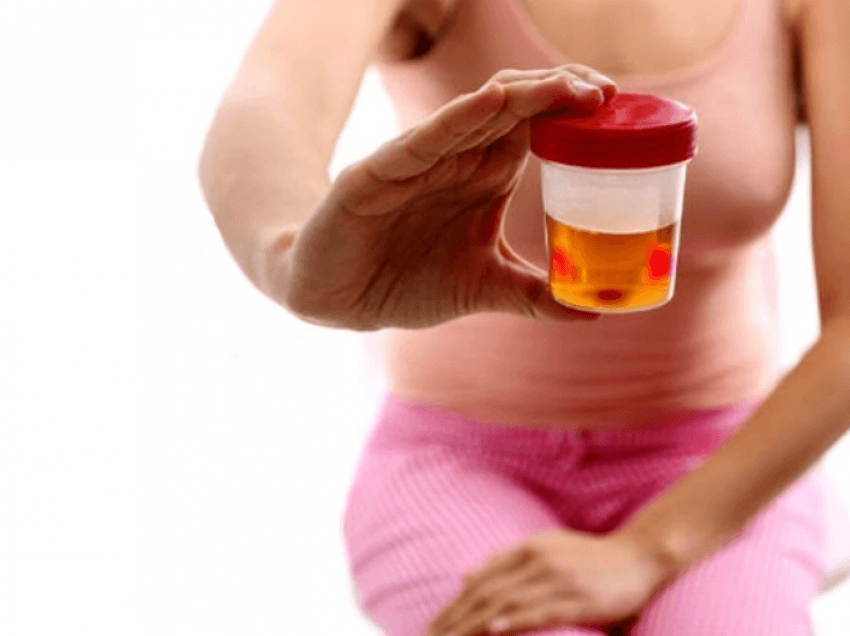 4 simptomat paralajmëruese të kancerit të fshikëzës së urinës