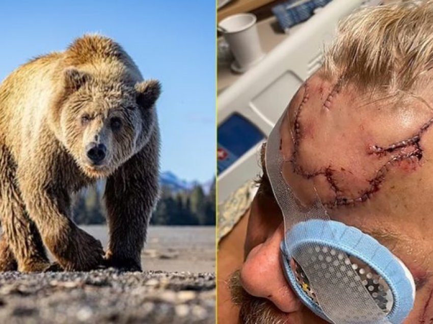 10 sekonda terror: Burri nga Alaska rrëfen luftën me ariun në një pjesë të pyllëzuar, pas së cilës mbijetoi