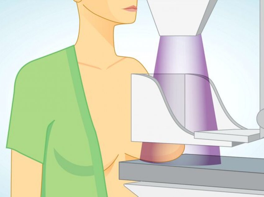 Kur dhe pse duhet ta bëni mamografinë?
