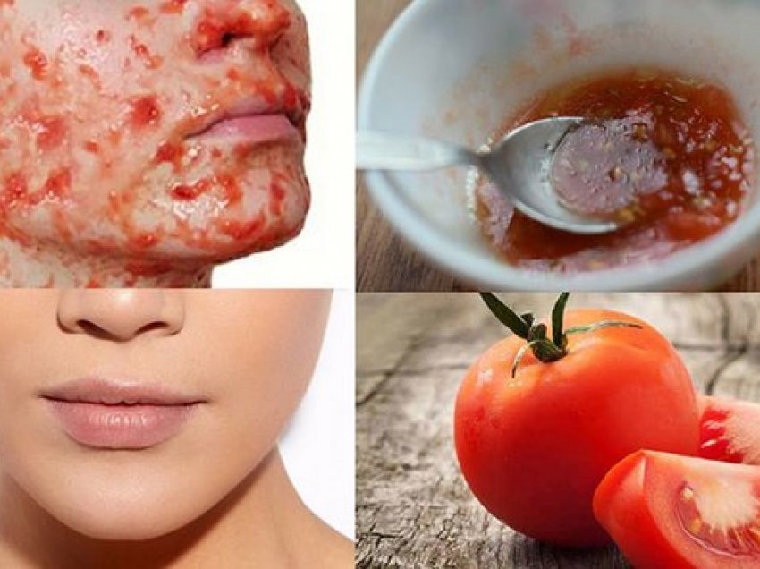 Ushqen dhe rigjeneron lëkurën më shpejt se gjithçka tjetër, ja pse duhet të bëni 1 herë në javë maskën me domate
