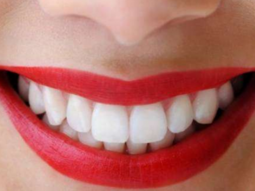 Këshillat që ju duhen për zhdukjen e ngjyrës së verdhë të dhëmbëve