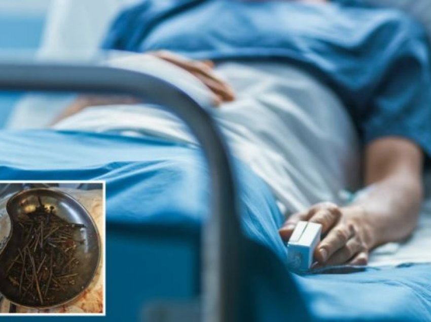 Mjekët në Lituani gjejnë mbi një kilogram gozhda dhe vida në stomakun e pacientit