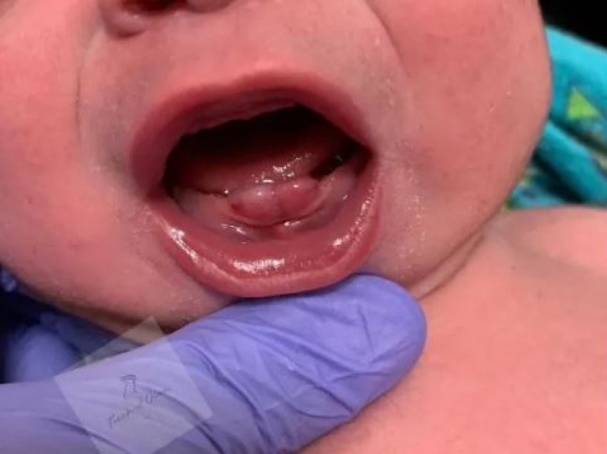 Foshnjat mund të lindin me dhëmbë, ja çfarë thonë ekspertët