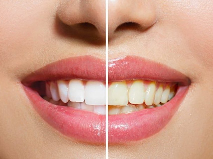Tri mënyra për të mbrojtur dhëmbët tuaj nga dëmtimi