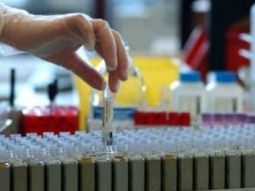 Laboratorët privatë në Shqipëri kanë 4-fishuar fitimet gjatë pandemisë së COVID-19