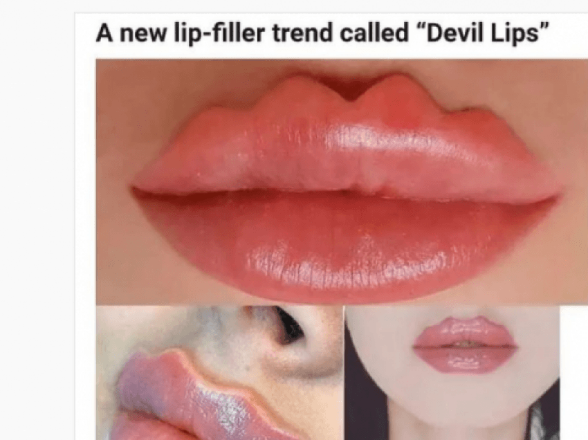 Trendi i ri i buzëve