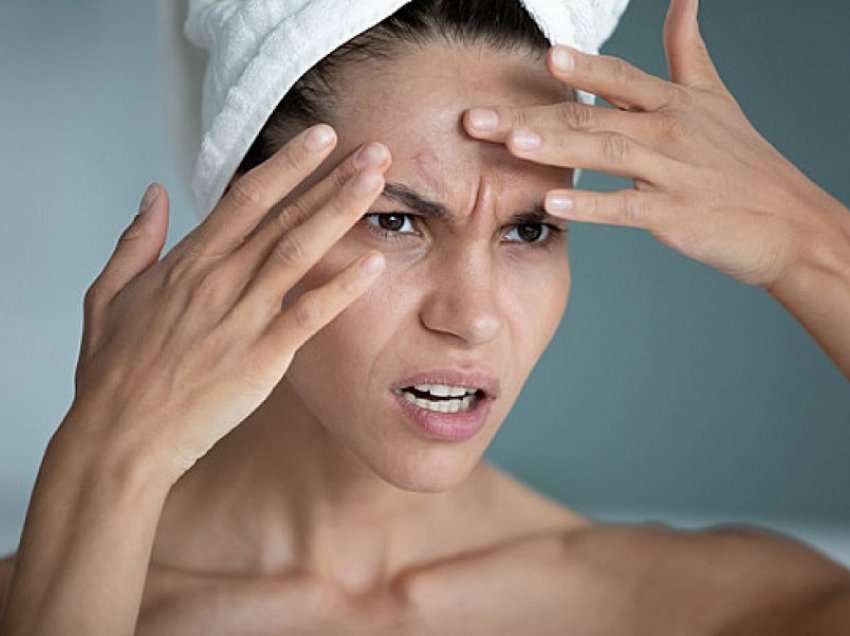 Keni probleme me lëkurën tuaj? Ja si stresi dhe ankthi ndikojnë në përkeqësimin e saj dhe si të gjeni “shpëtim”