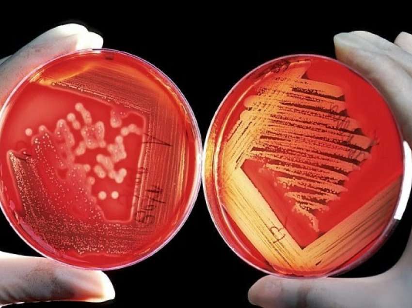 Shkencëtarët zbulojnë molekulën që shkatërron 300 baktere rezistuese ndaj antibiotikëve