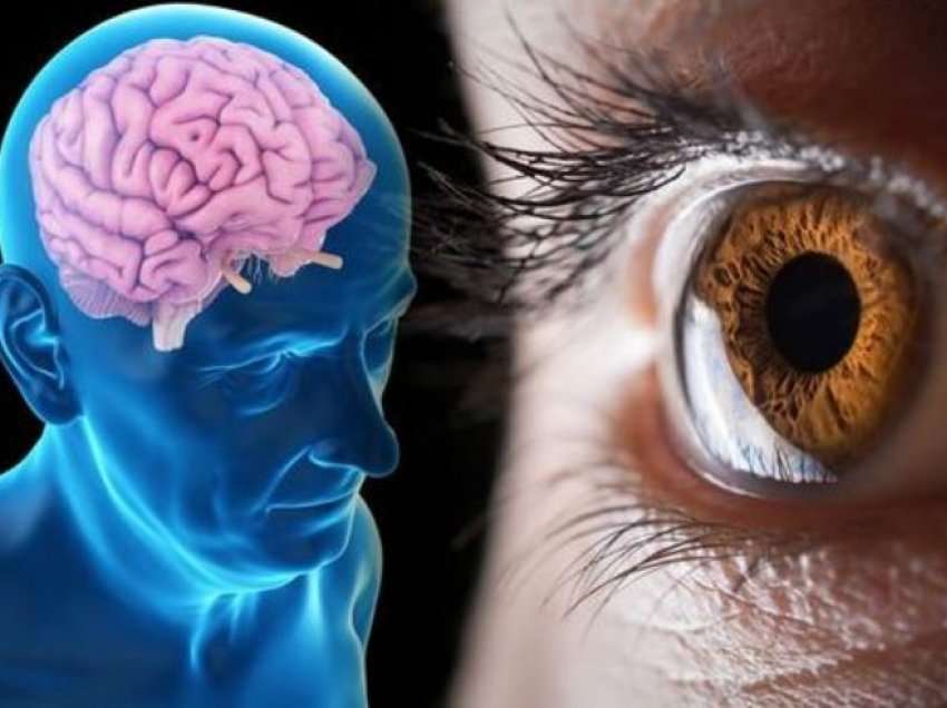 Ekzaminimet e syve mund të ndihmojnë në identifikim për rrezik të demencës te të moshuarit