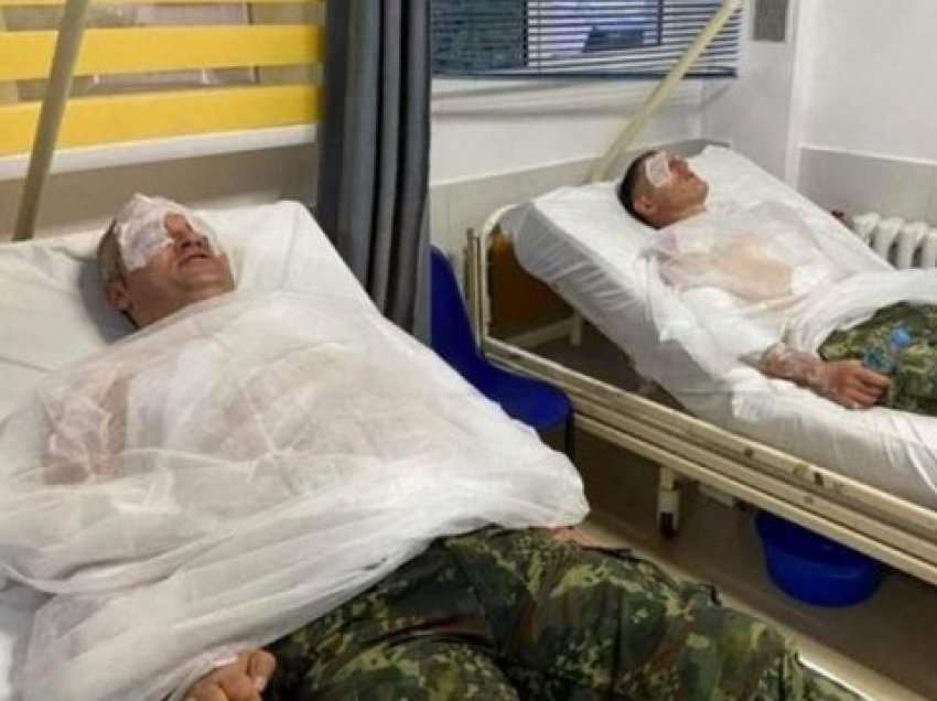 U sulmuan me armë kimike nga rusët, kjo është gjendja e dy ushtarëve shqiptarë