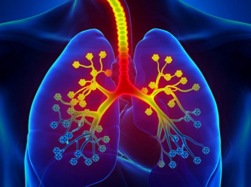 Sëmundja që prek rrugët e frymëmarrjes: Simptomat që duhet të kini kujdes