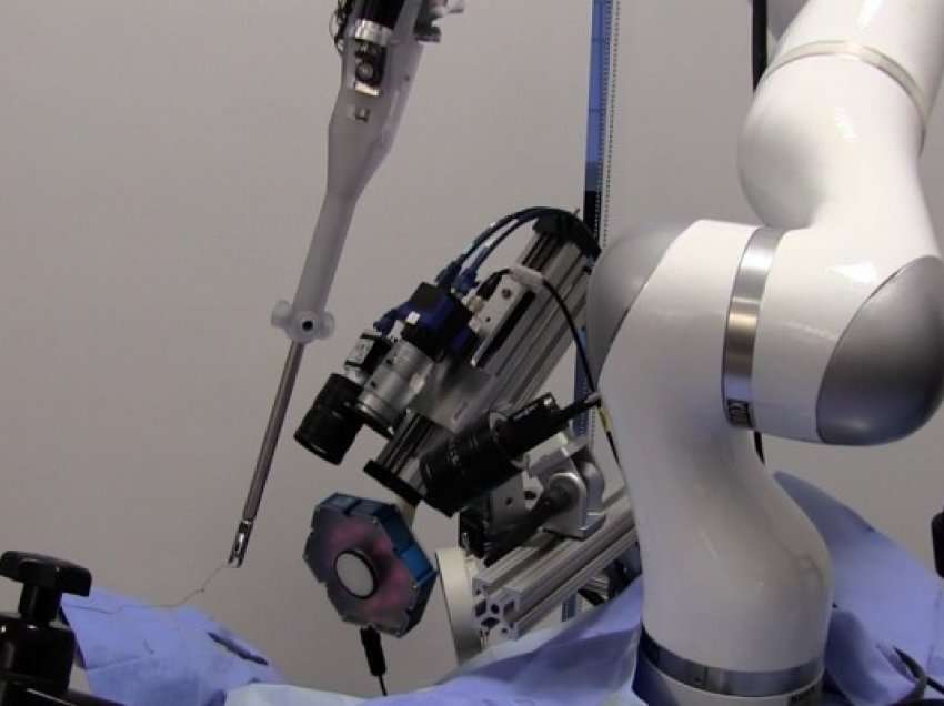 ​Kryhet operacioni i parë laparoskopik me anë të robotit
