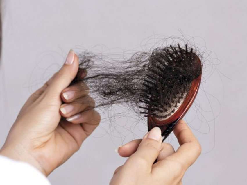 Dermatologu shpjegon pse flokët bien pas kalimit të koronavirusit