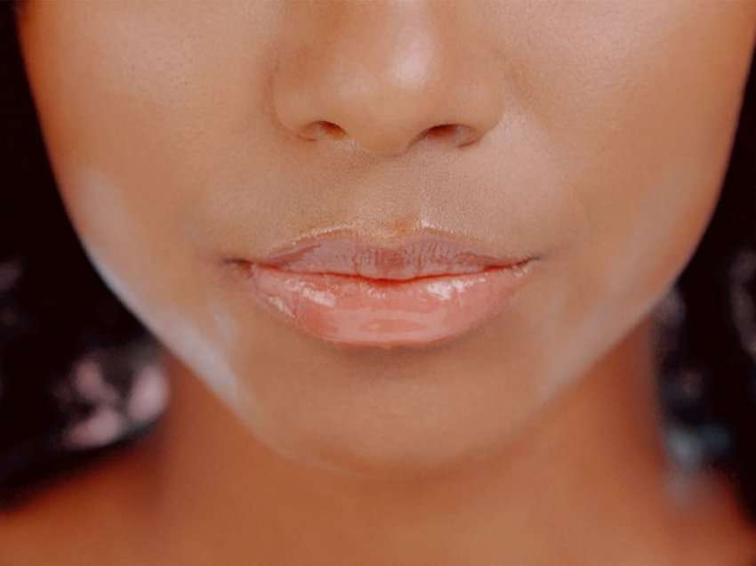 Buzët humbasin ngjyrën me kalimin e kohës, çfarë duhet të bëni sipas dermatologëve?