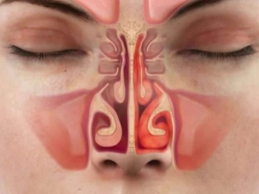 7 arsyet pse zgjoheni me hundë të bllokuara edhe kur nuk jeni të sëmurë