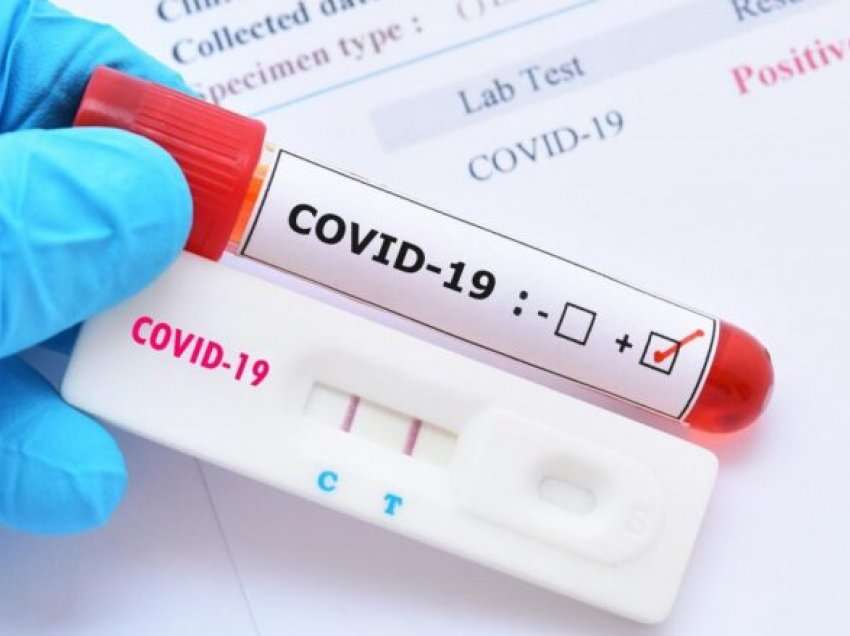 3 mijë e 159 raste aktive me COVID-19 në Shqipëri