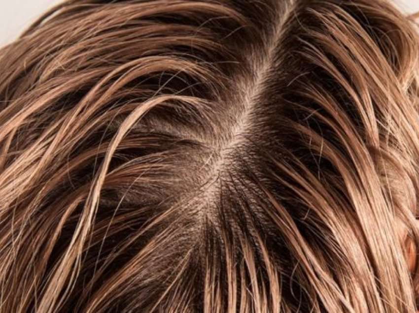 Pse flokët bëhen më të yndyrshme gjatë stinës së dimrit?