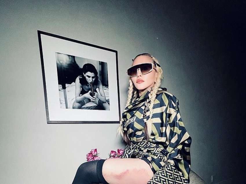 Kush e rrahu Madonnën? Këto foto të këngëtares kanë shqetësuar fansat