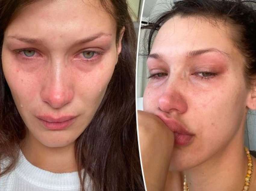 Bella Hadid flet për shëndetin mendor dhe rrëfen arsyen pse postoi fotot duke qarë