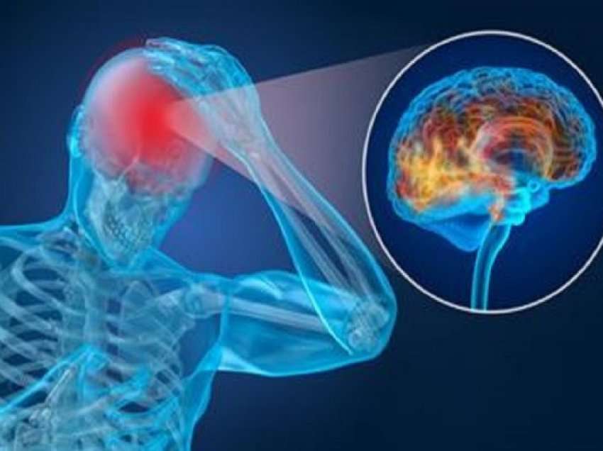 ​Pse migrena kronike është më shumë se një dhimbje koke