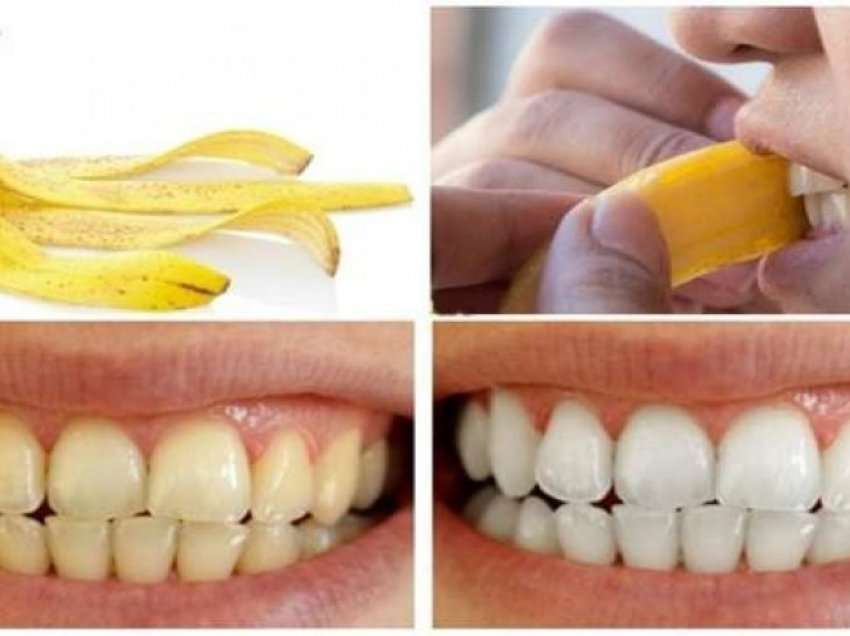 Kjo është metoda shumë efikas si t'i bëni dhëmbët tuaj të bardhë