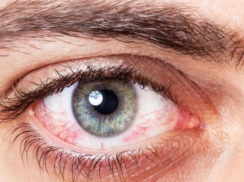 Çfarë tregon ngjyra e syve për shëndetin tuaj?