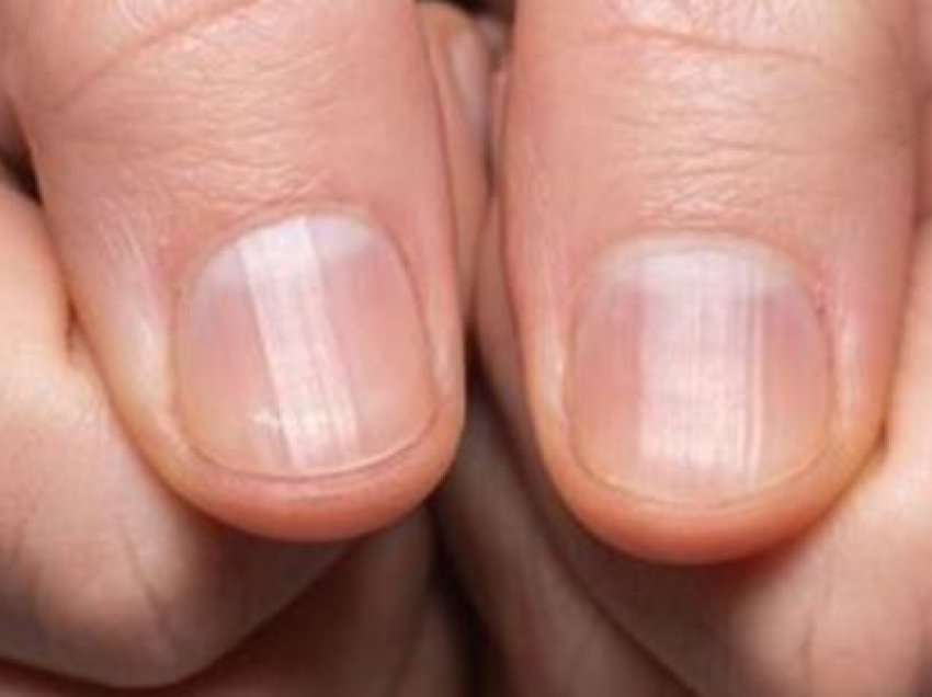 Gjatësia e gishtit tuaj mund të tregojë rrezikun për tu prekur nga kanceri