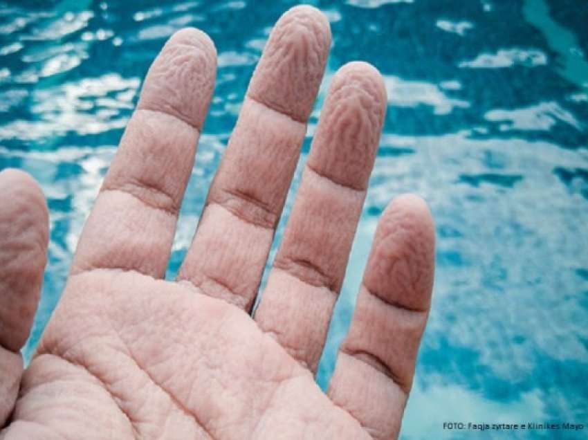 Pse rrudhet lëkura në gishta kur qëndron nën ujë?