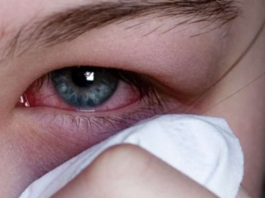 Zbuloni si ndikon tensioni i lartë i gjakut në shëndetin e syve
