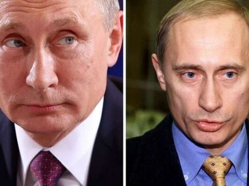 A do t’i duhet Putinit të ndalojë përdorimin e botoksit?
