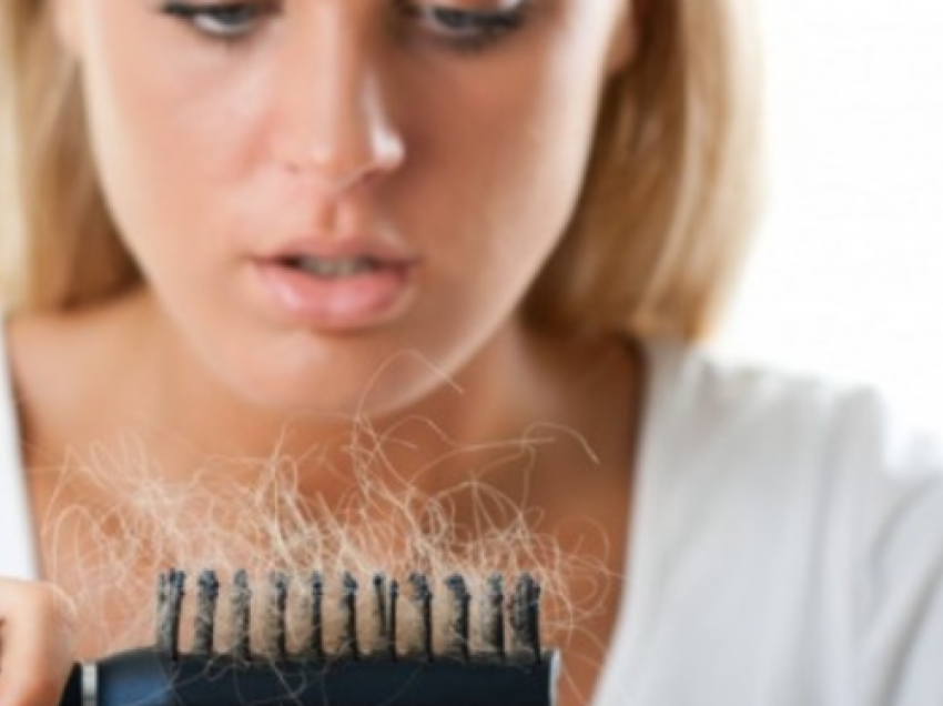 10 mënyra për të parandaluar rënien e flokëve
