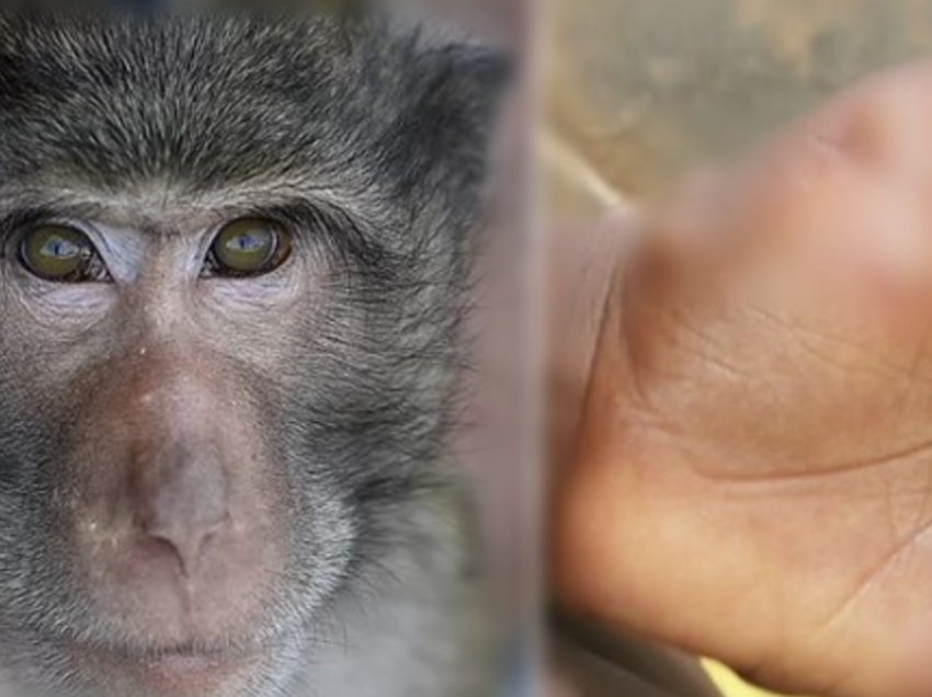 Belgjika shteti i parë që vendos karantinën 3-javore për të infektuarit nga lija e majmunëve