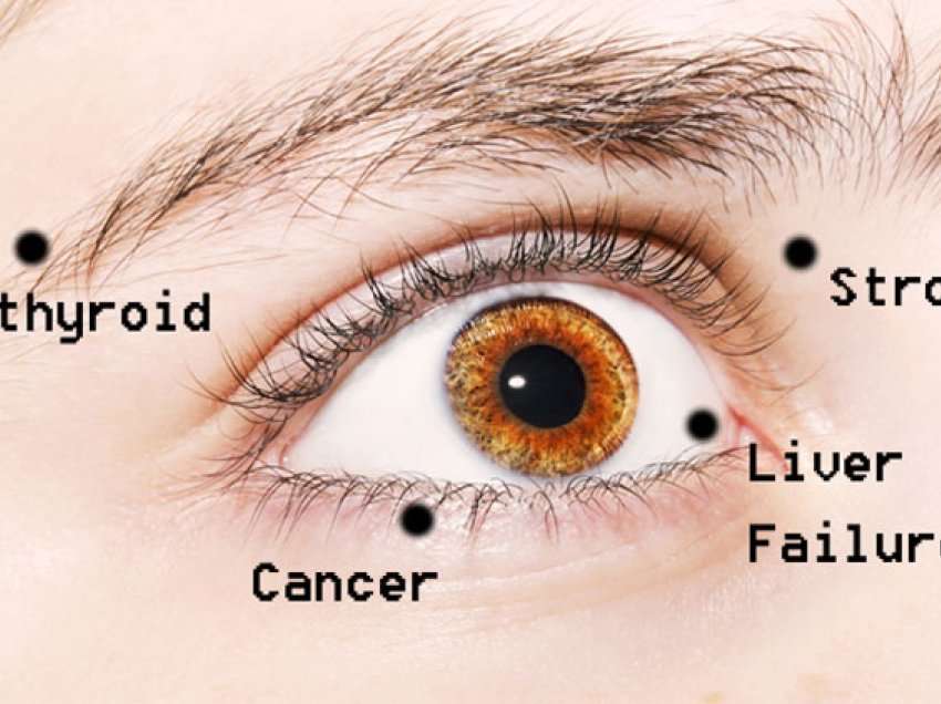Sytë pasqyrë e shëndetit, ja 8 sëmundjet që mund t’i dalloni përmes tyre