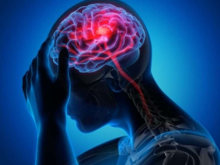 Sa i rëndësishëm është parandalimi për të parandaluar goditjen në tru?