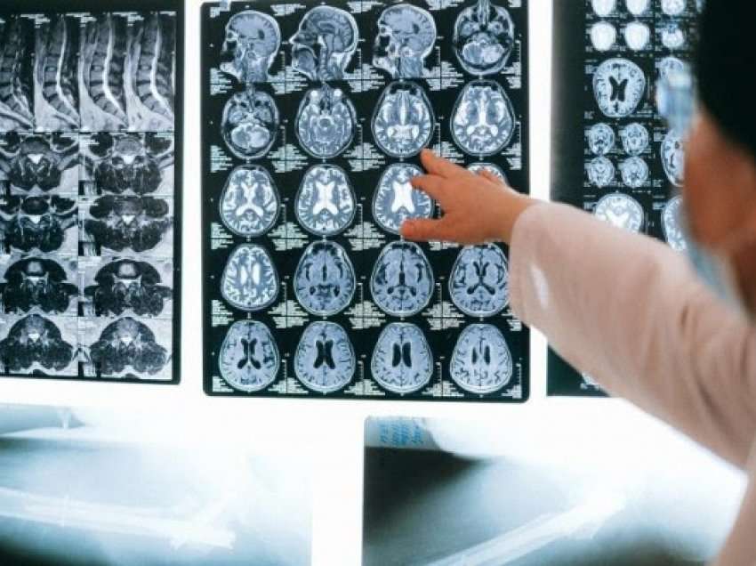 ​Mjegulla e trurit: Shkaku, simptomat dhe si ta trajtojmë këtë problem që mundon shumë?