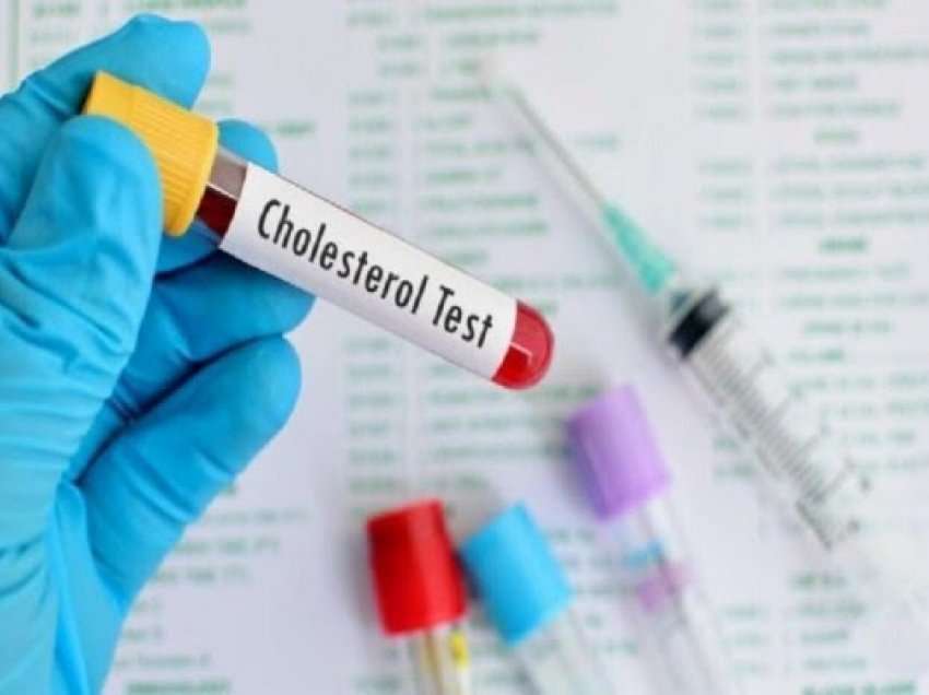 ​Hulumtimi i ri: Kolesteroli i mirë mund të mos jetë aq mbrojtës sa mendohet