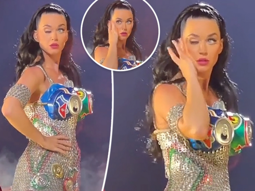 Katy Perry sqaron se çfarë i ndodhi me syrin në videon virale