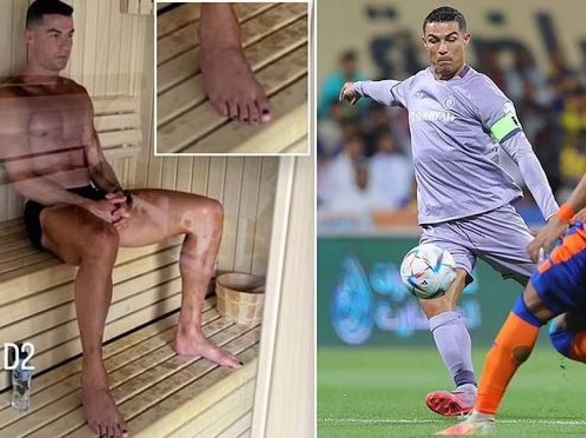 Pse Ronaldo i lyen thonjtë me ngjyrë të zezë?