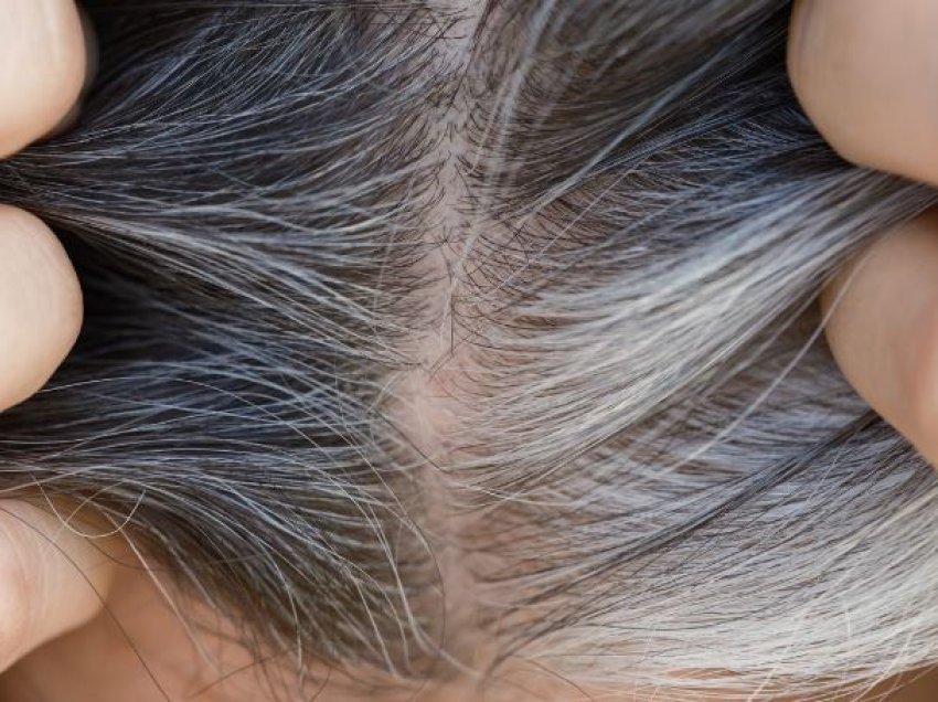 Shkencëtarët amerikanë zbulojnë arsyen pse flokët thinjen ndërsa plakemi