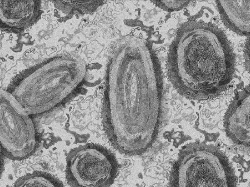 OBSH po gjurmon variantin e ri të koronavirusit 