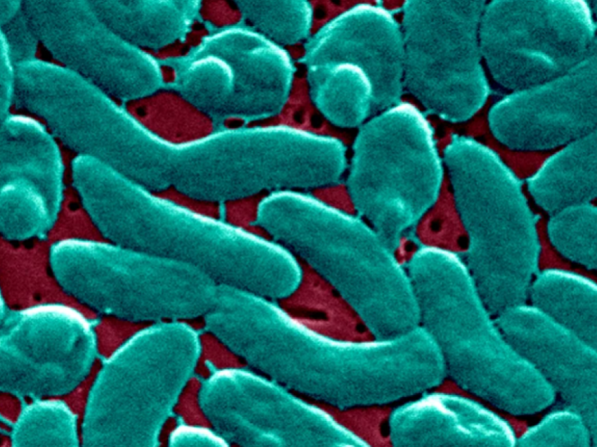 Tre persona vdesin nga infeksionet e “baktereve mishngrënëse”, autoritetet në SHBA në alarm