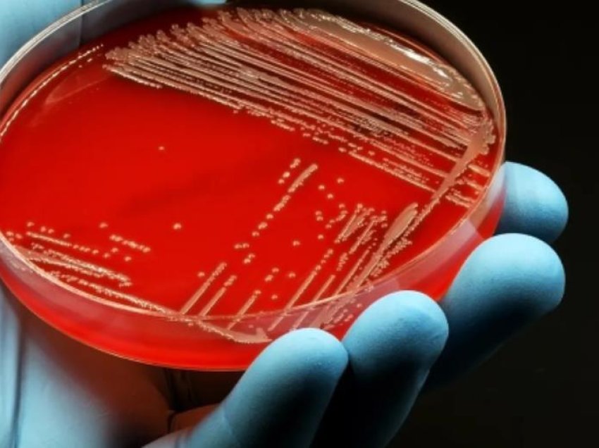 A i fshijnë vërtet antibiotikët bakteret e zorrëve? 