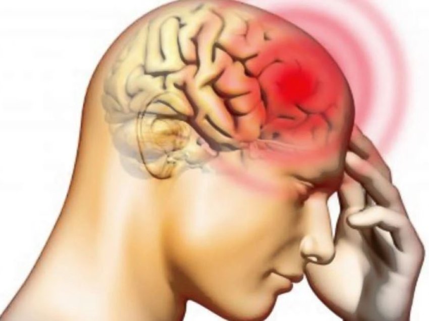Shenjat paralajmëruese të dhimbjes së kokës! Gjashtë simptoma të pazakonta që mund të sinjalizojnë probleme serioze