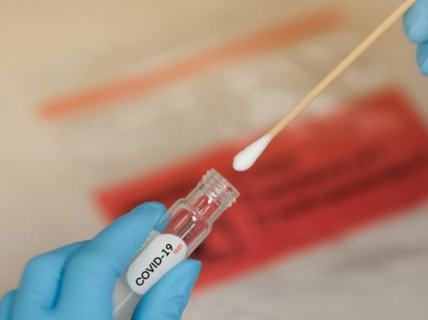 Qytetarët e Maqedonisë shpenzuan afër 20 milionë euro për testet PCR në shëndetësinë private