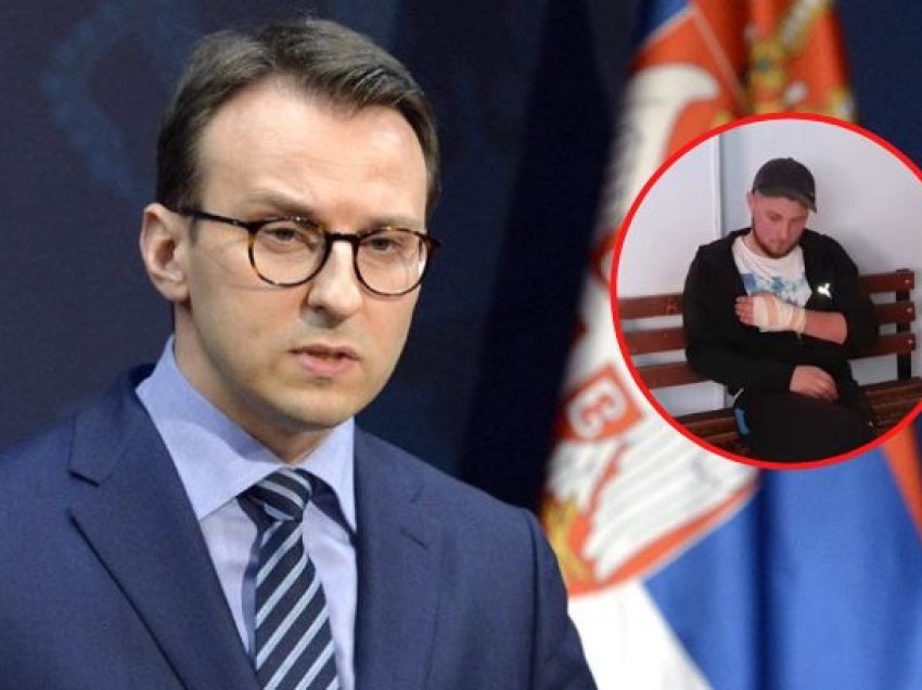 Petkoviq për plagosjen në Shtërpcë: Mbetet tentativë për të vrarë fëmijë të pafajshëm serbë