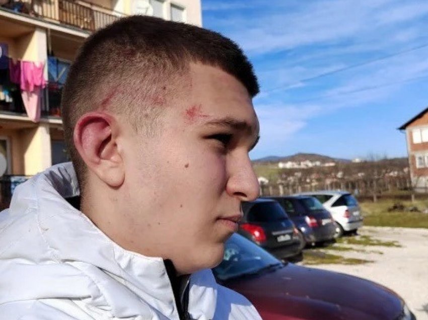 Zllatibori pretendon se katër shqiptarë ia rrahën djalin e tij 15-vjeçar në Suhodoll “vetëm pse ishte serb”